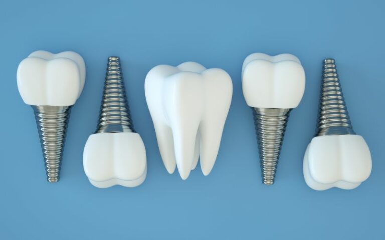 Dental implants