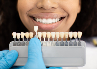 A person smiles widely, revealing white teeth, while a gloved hand holds a dental shade guide in front of their mouth. The guide displays various shades of artificial teeth labeled with codes, used to match dental restorations to the patient's natural teeth.