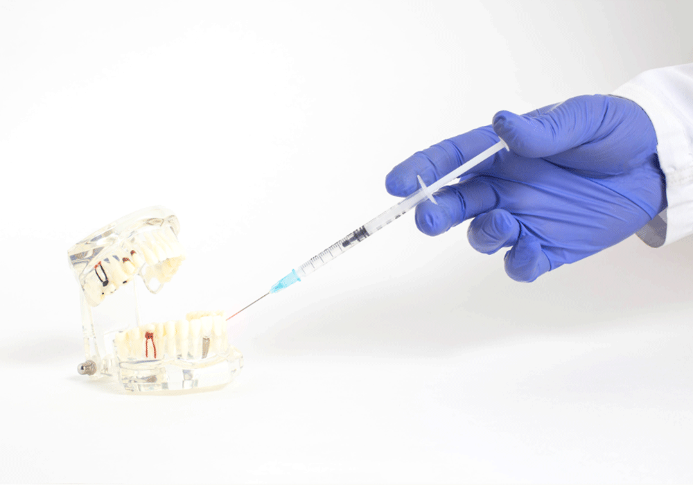 Hand with blue glove holding a syringe, injecting into a dental model.